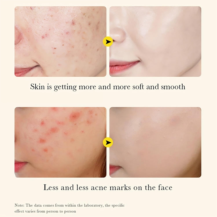 Turmeric Serum