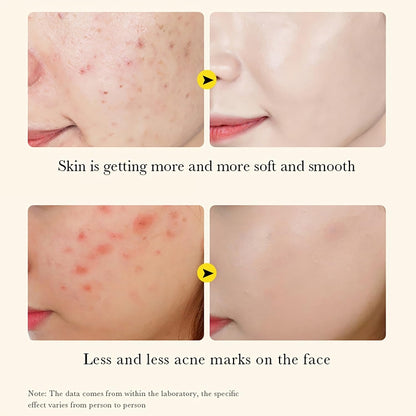 Turmeric Serum