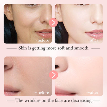 Niacinamide/Nicotinamide Serum