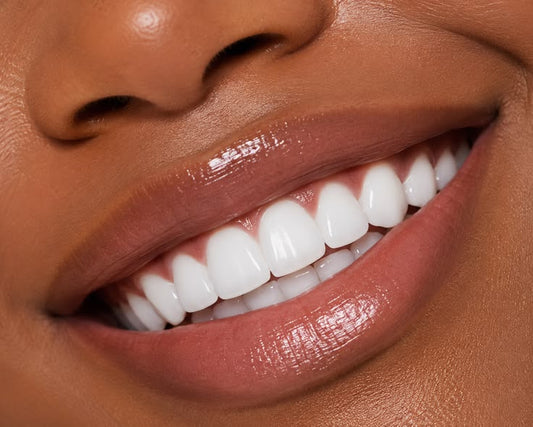 Teeth Whitening Kit